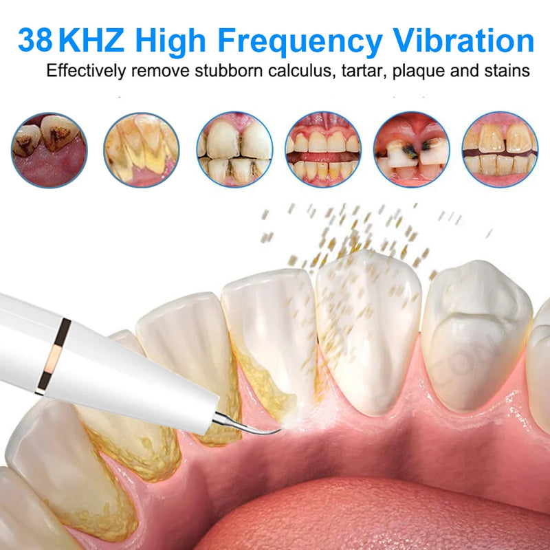 Ultrassônico Dental Removedor de Tártaro